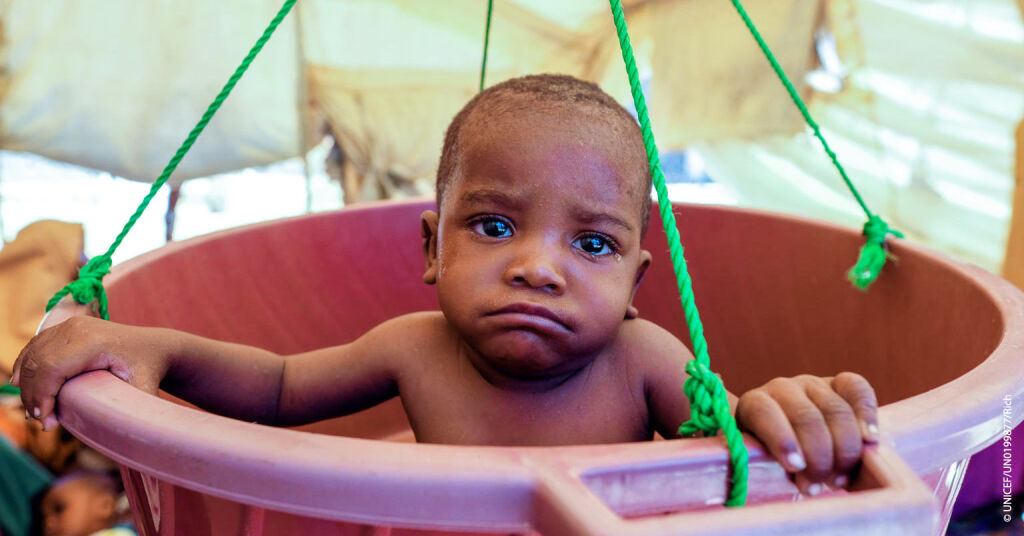 Lapsi tuotiin punnittavaksi UNICEFin tukemaan ravitsemuskeskukseen Dalxiiskan maansisäisten pakolaisten leirille Somaliassa. © UNICEF/UN0199877/Rich