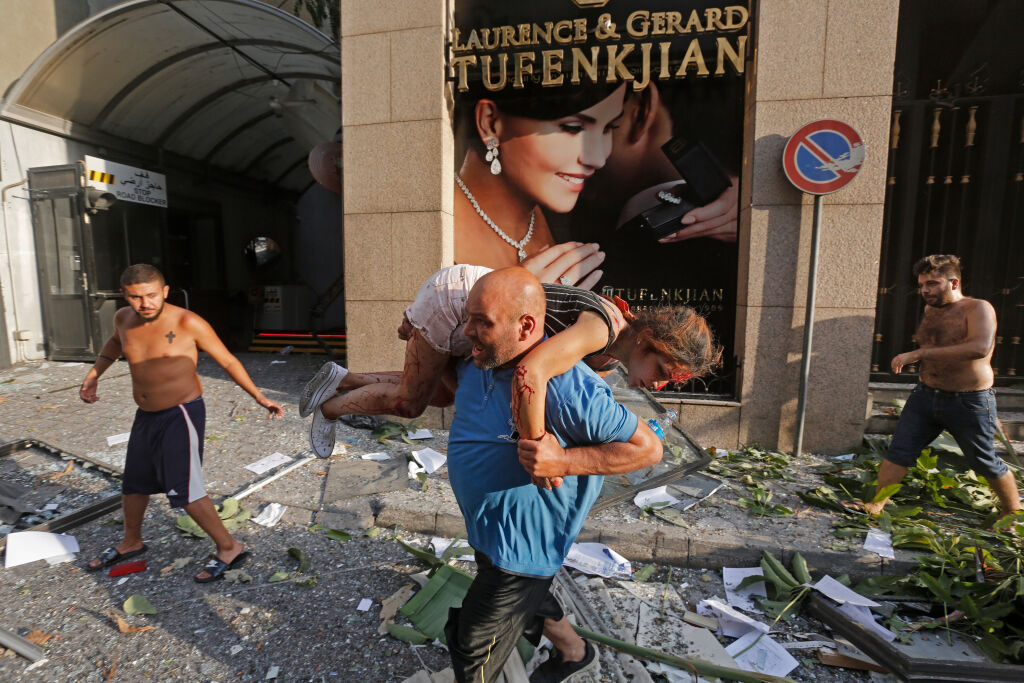 Mies kantoi räjähdyksissä loukkaantunutta tyttöä tiistai-iltana Beirutissa. © UNICEF/UNI356270/Tahtah/AFP