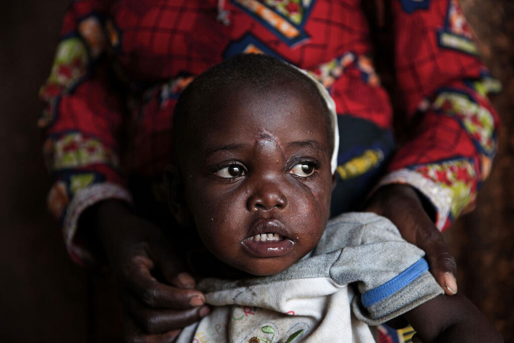 Rachel Ngabusi, 2, Djugun siirtymäleirillä Buniassa, Kongon demokraattisessa tasavallassa. Rachelin äiti ja kolme veljeä kuolivat Ituriin tehdyissä iskuissa vuoden 2018 alussa. © UNICEF/UN0270764/Oatway