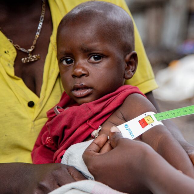 UNICEFin työntekjjä mittaa pienen lapsen käden ympärysmittaa, jolla tutkitaan aliravitsemusta.