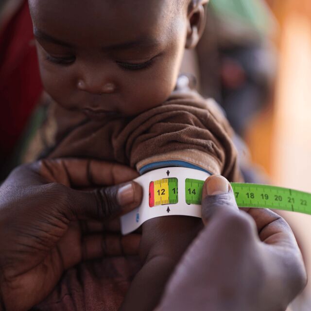 Pienen lapsen käsivarresta mitataan aliravitsemusta. 