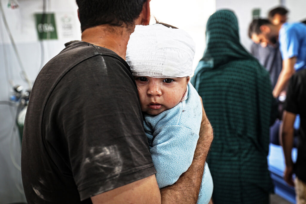 Vauva side päässä aikuisen sylissä.