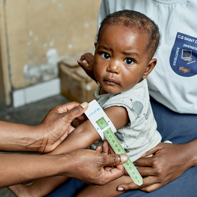 Pienen lapsen käsivarresta mitataan aliravitsemusta mittanauhalla. 